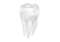endodoncia