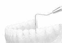periodoncia